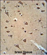 Mouse Monoclonal Antibody to ALDH2