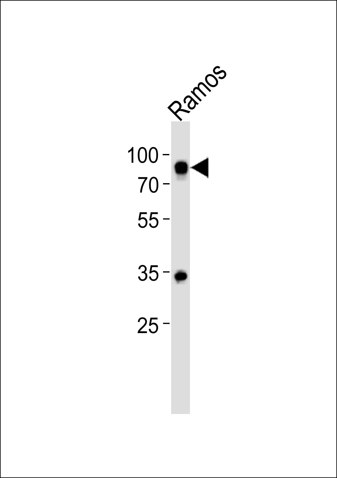 CD19 (N-term)