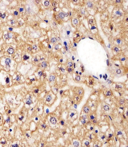 Rabbit Polyclonal Antibody to AGAP8