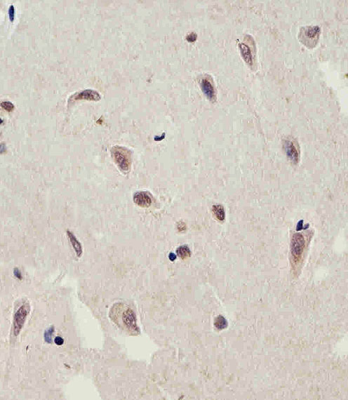 Rabbit Polyclonal Antibody to C13orf30