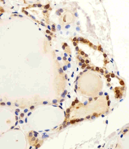 Rabbit Polyclonal Antibody to C13orf30