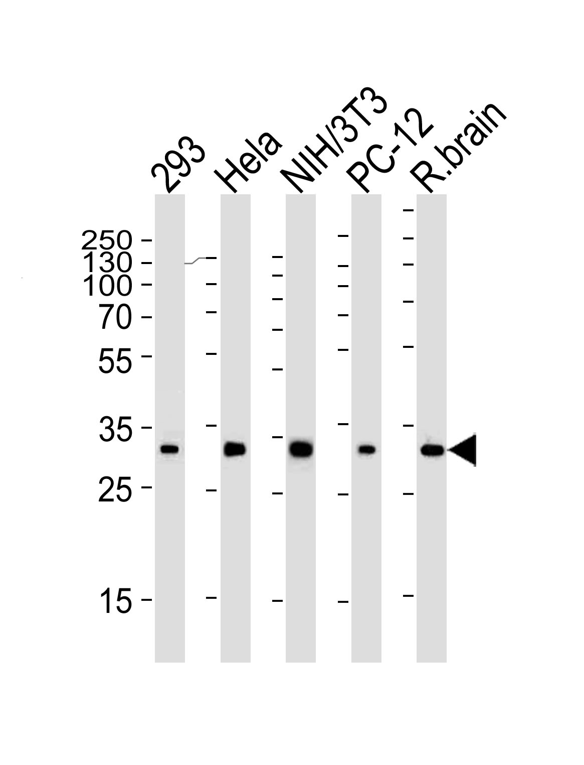 RPS6 (N-term)