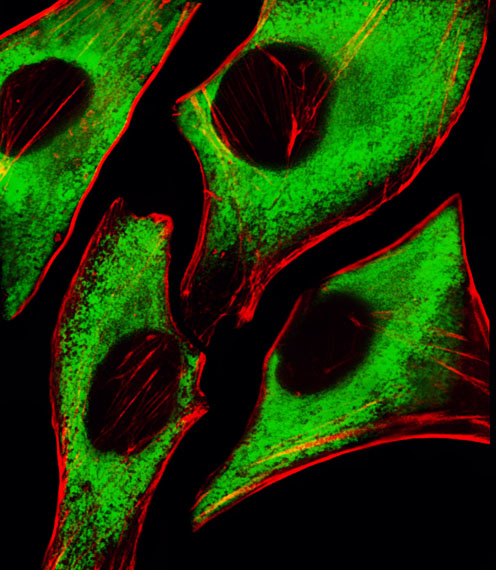 Mouse Monoclonal Antibody to RPS6 (N-term)