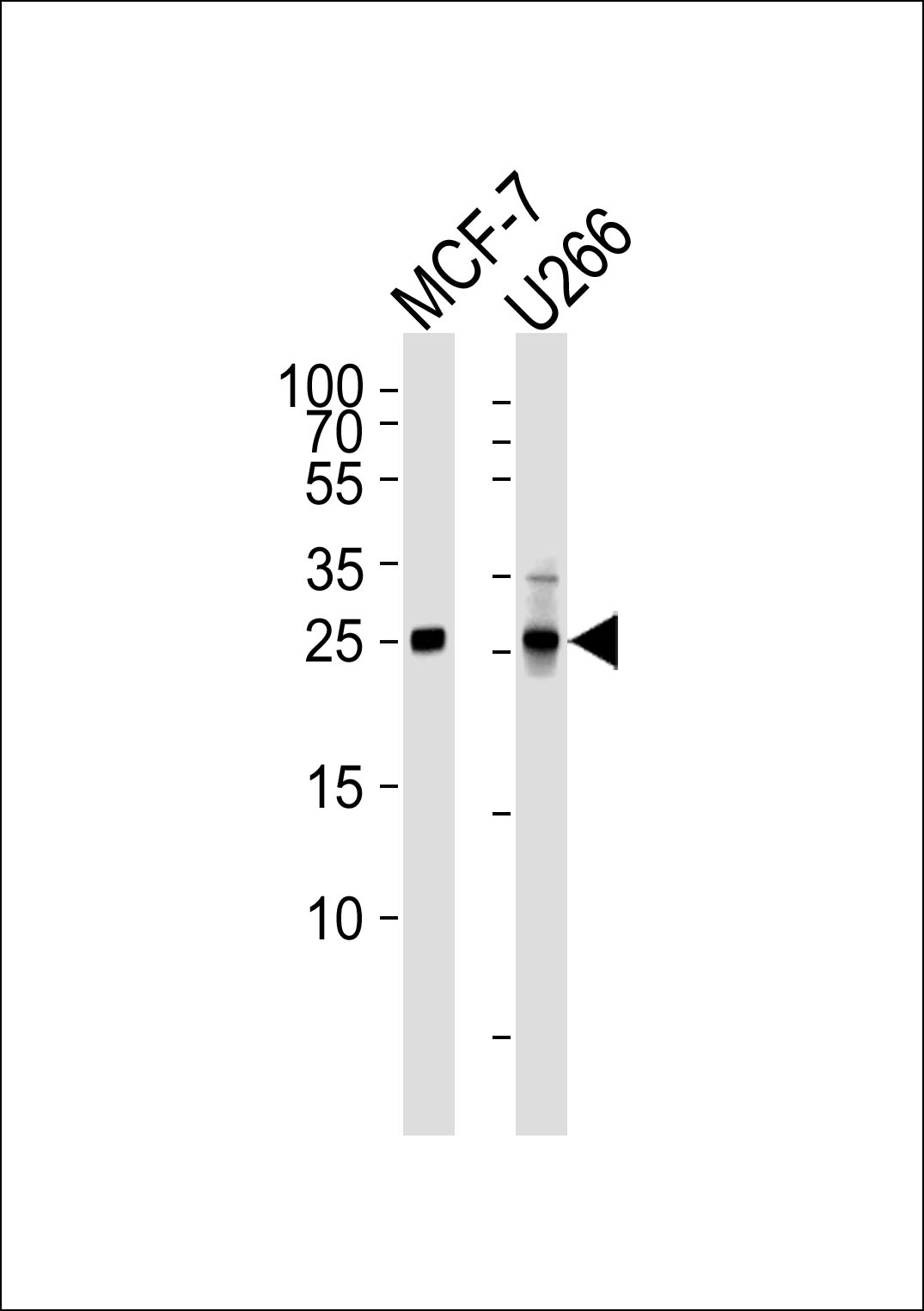 CDKN1B