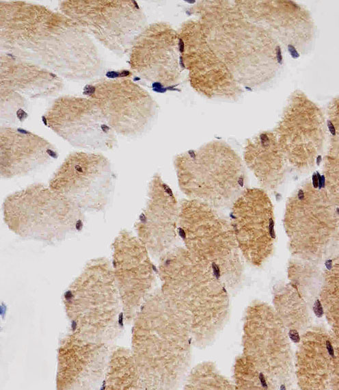 Mouse Monoclonal Antibody to CDKN1B