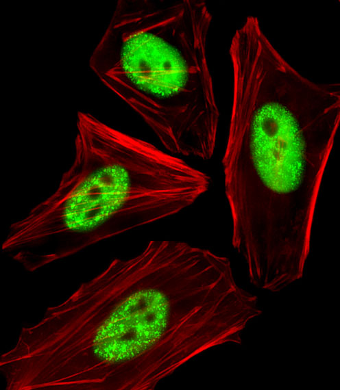 Rabbit Polyclonal Antibody to Phospho-CDC25A(T507)