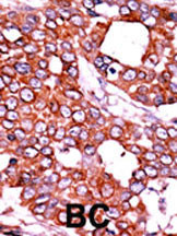 Rabbit Polyclonal Antibody to Phospho-CDC25A(T507)
