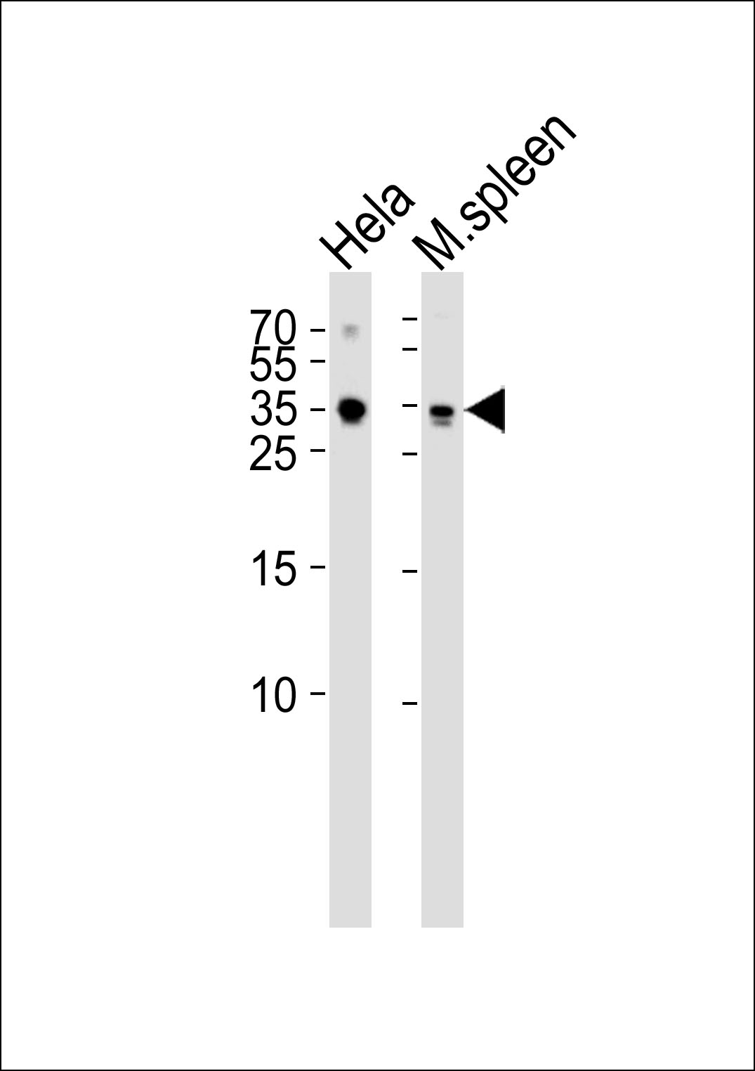 TCF21