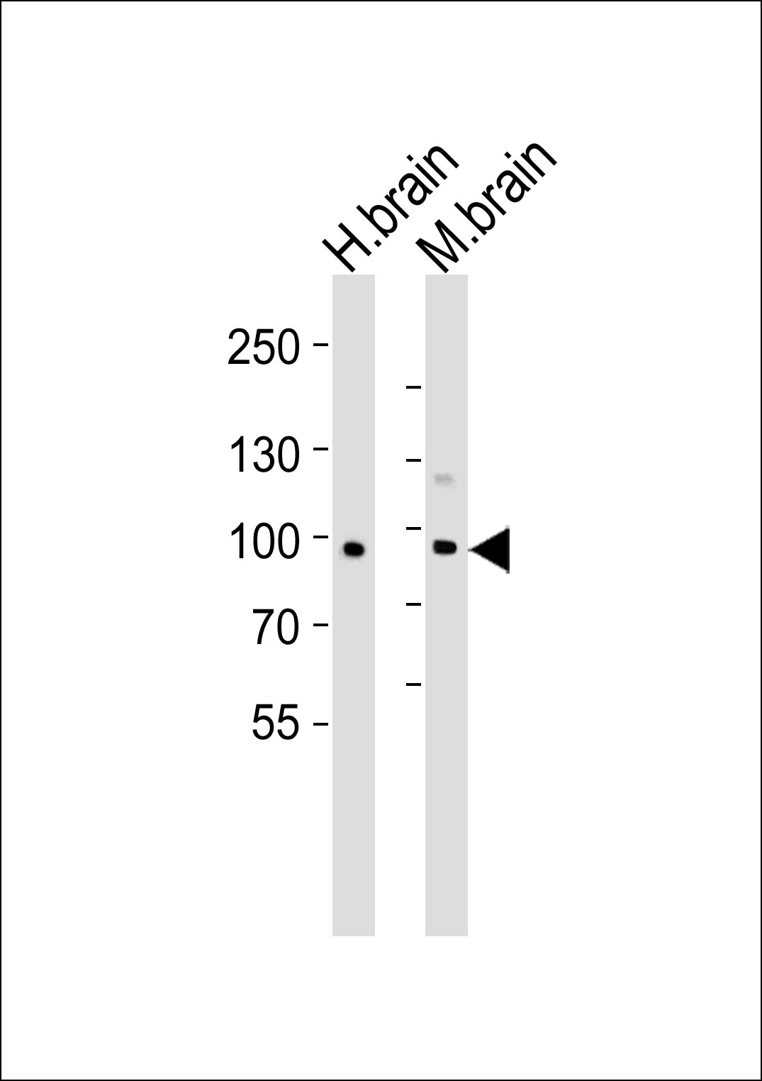 CDH20 (N-term)