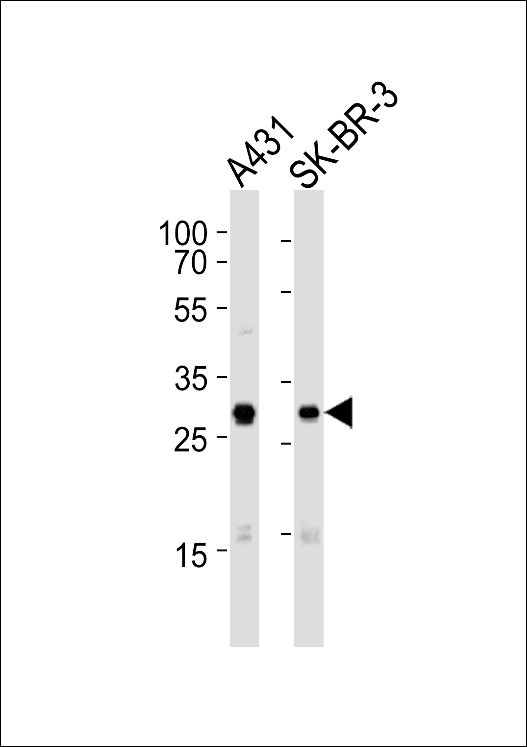 Mouse Cdk1