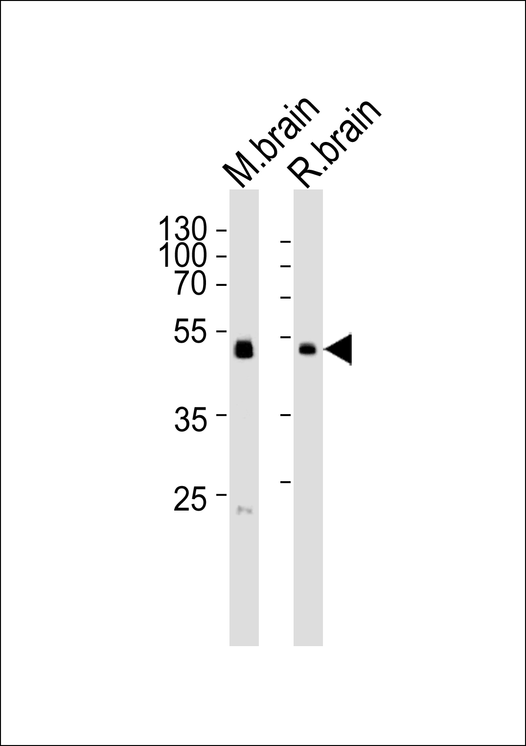 PIP4K2C (N-term)