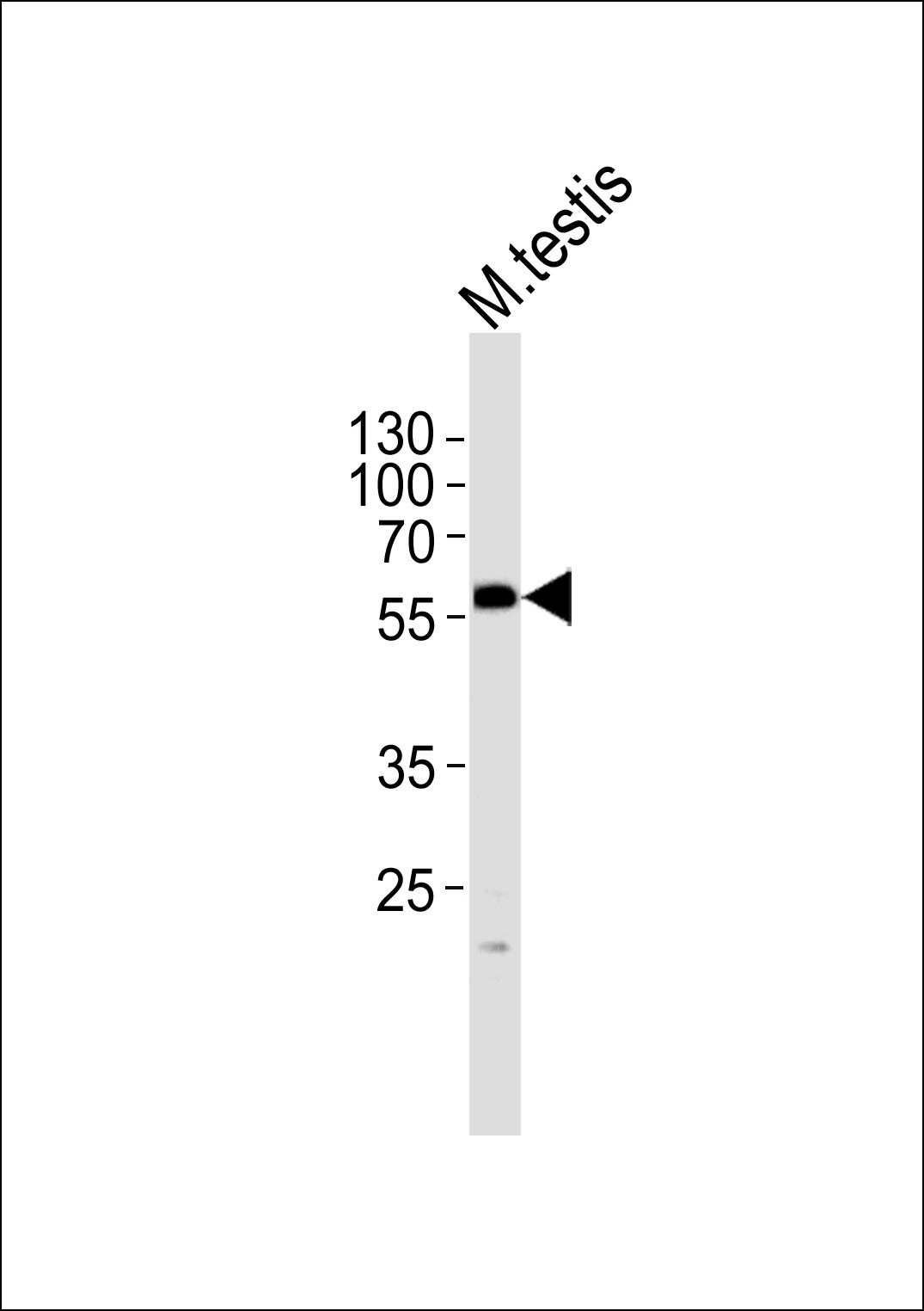 PHF1 (N-term)