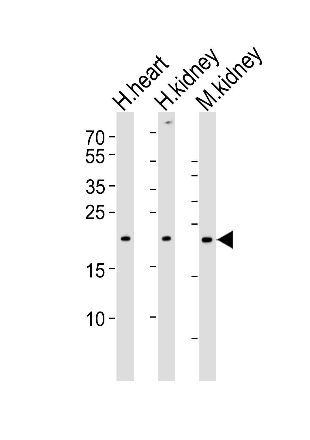 CYS1  (C-term)