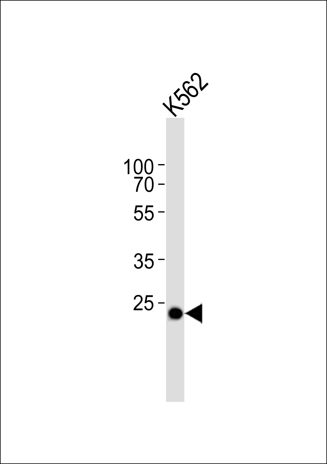 C21orf33