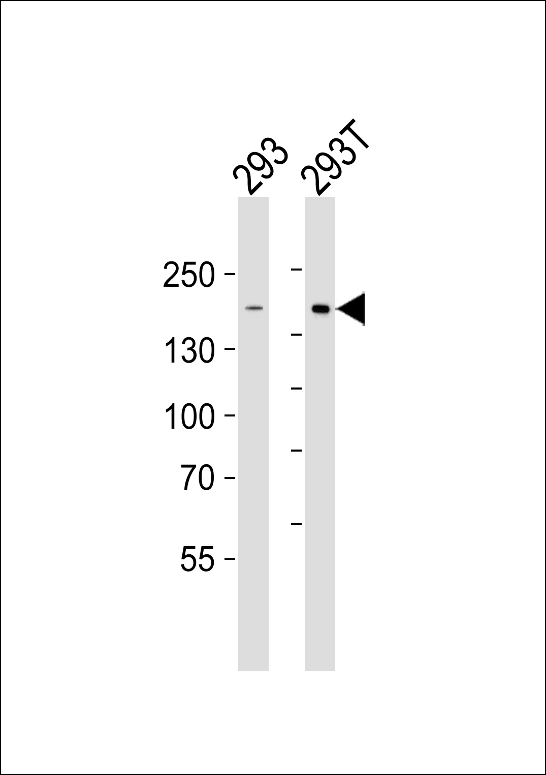 DIAPH1 (N-term)