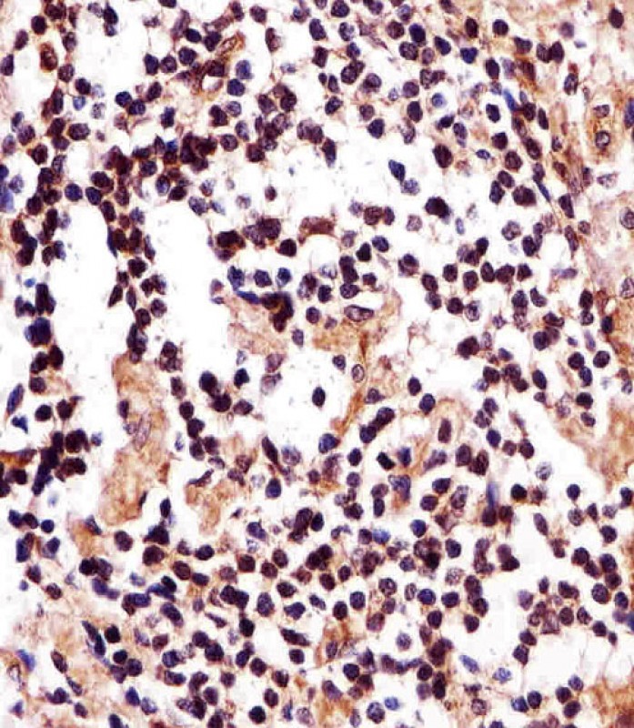Rabbit Polyclonal Antibody to IZUMO2