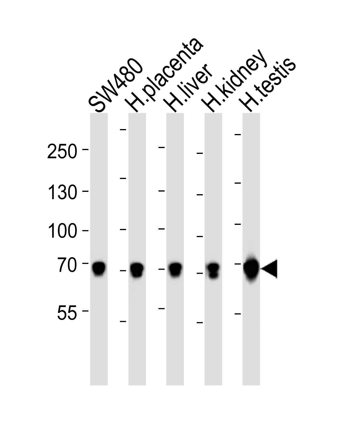 TRPV6