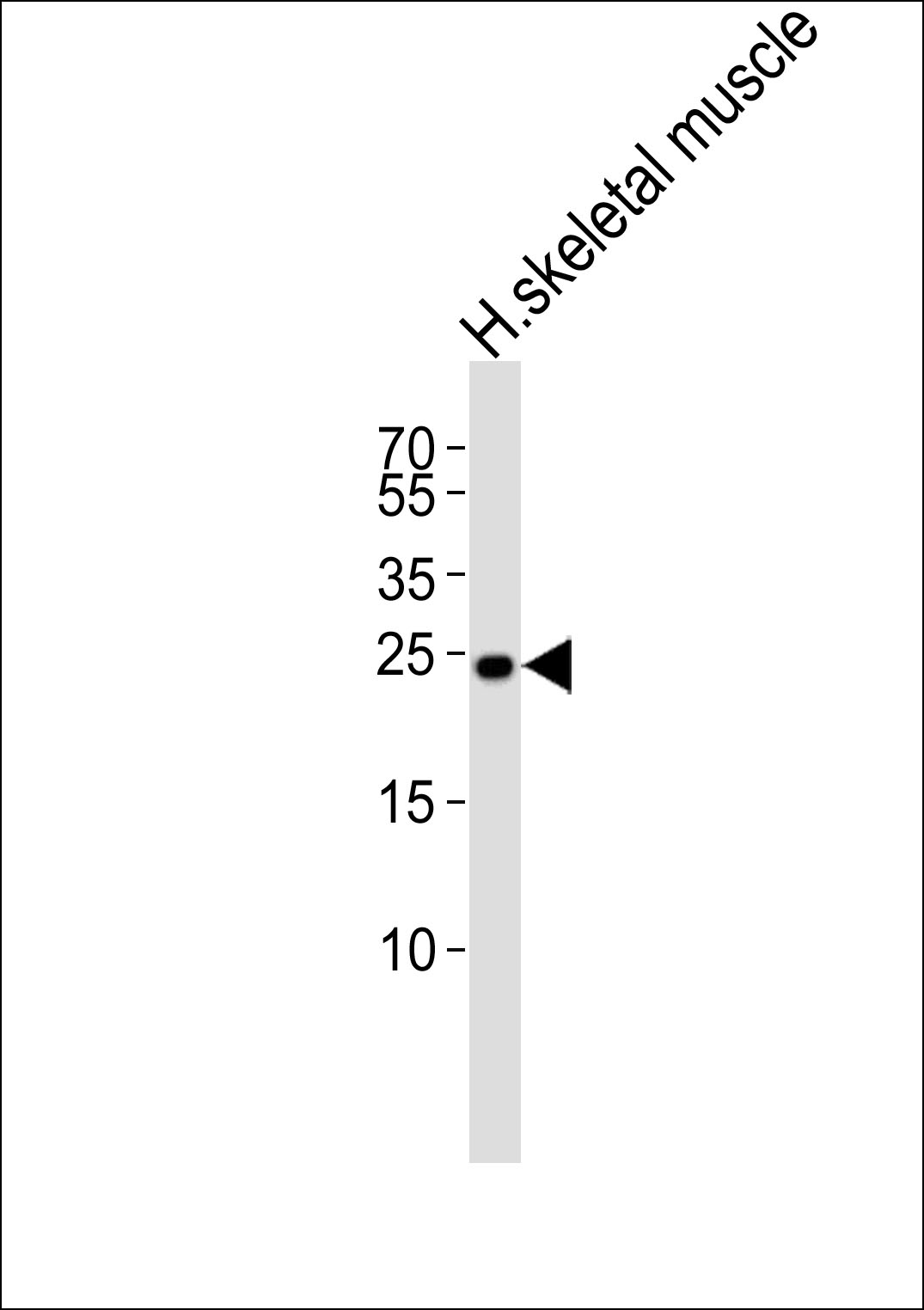 TMEM239 (N-term)