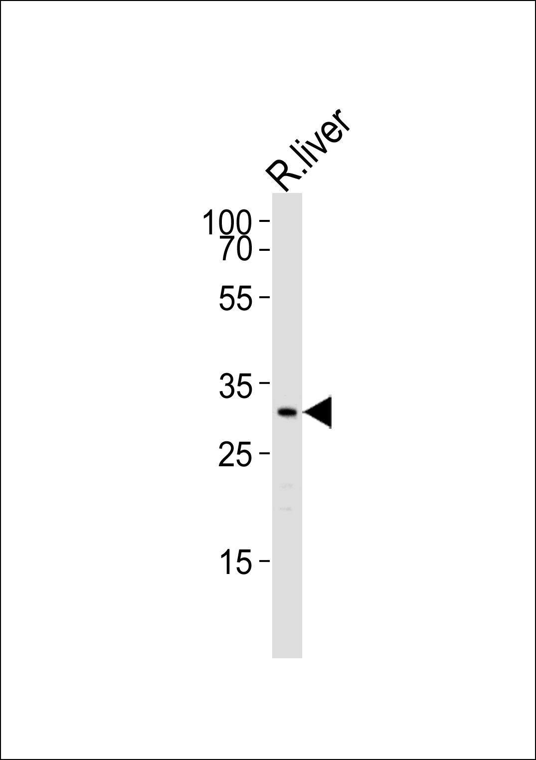 Rat-Cebpb-S105