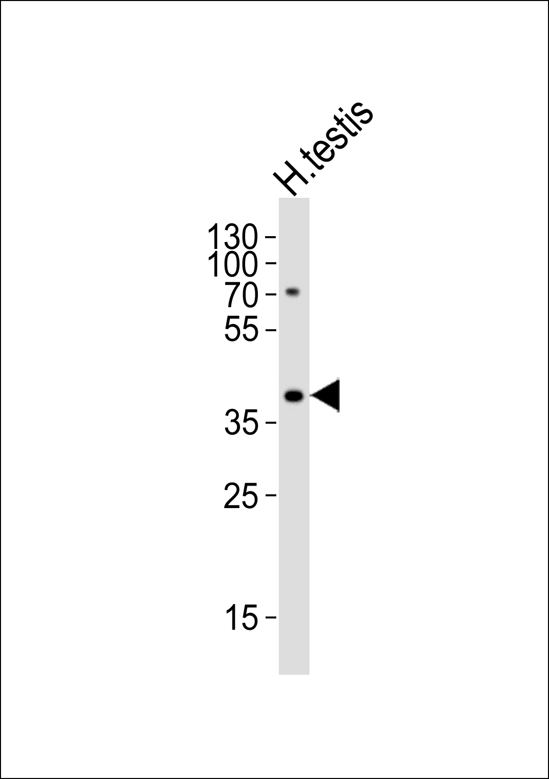 TSPY2