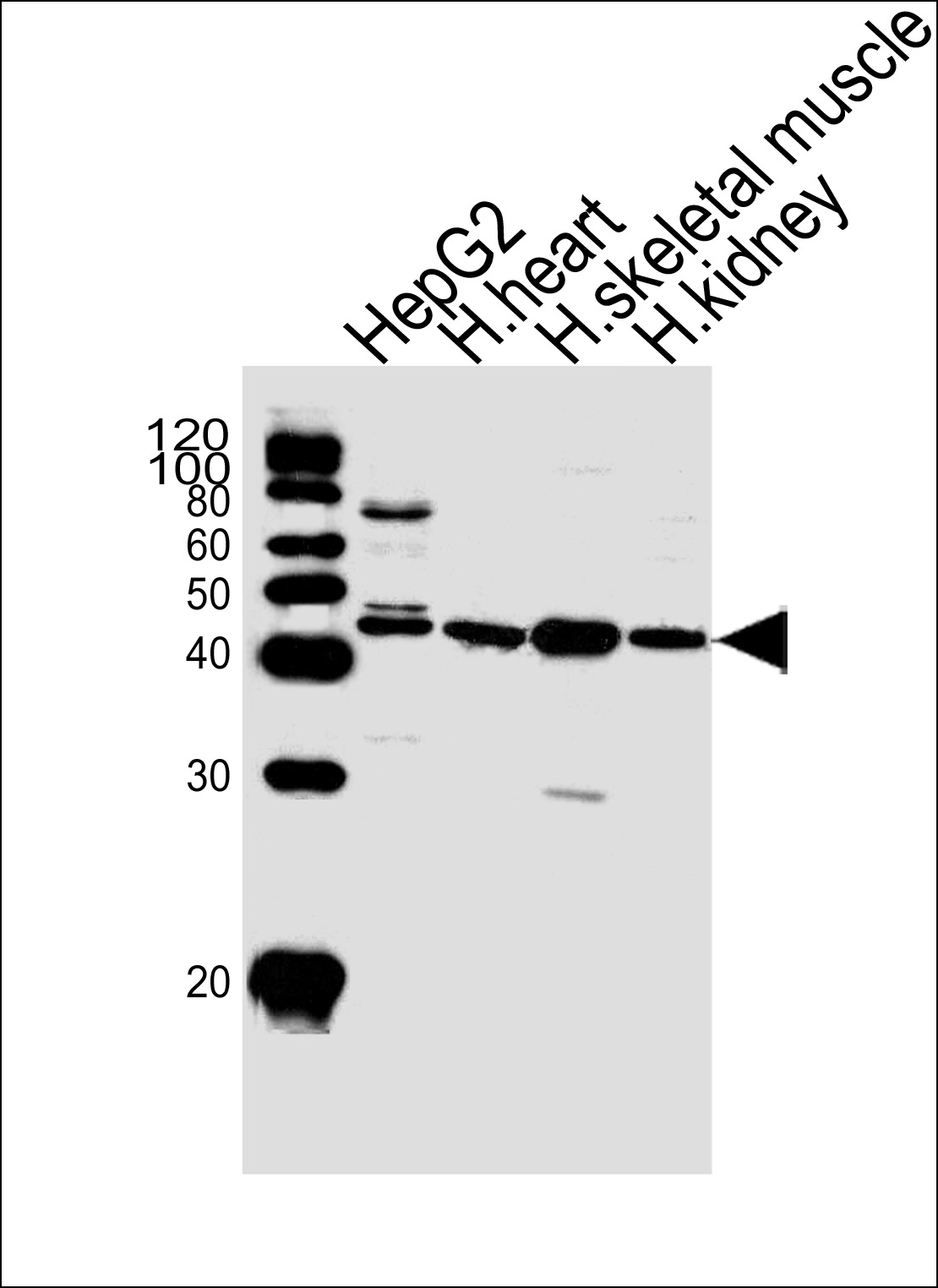 SPHK1 (N-term P74)