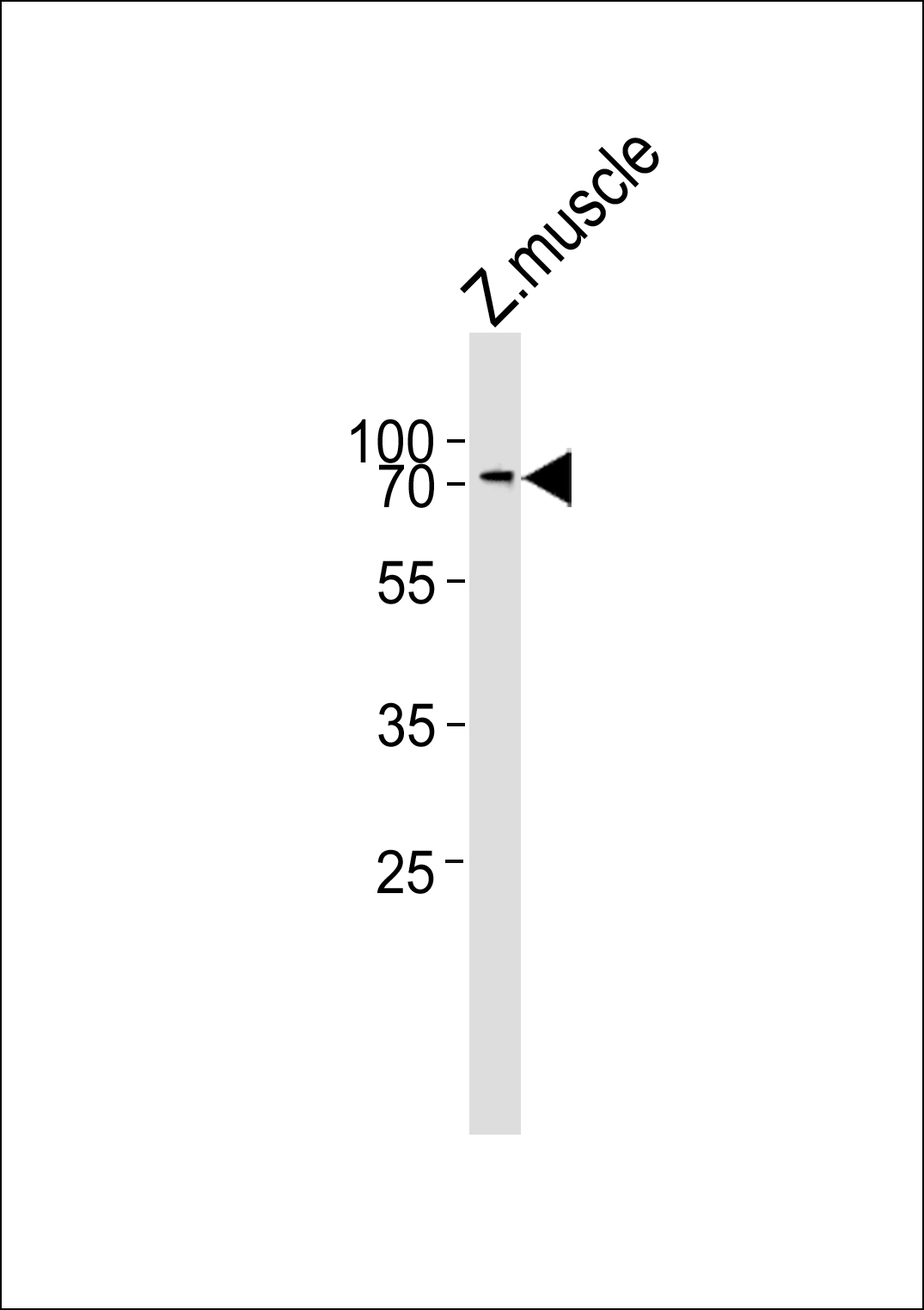 (DANRE) znf143