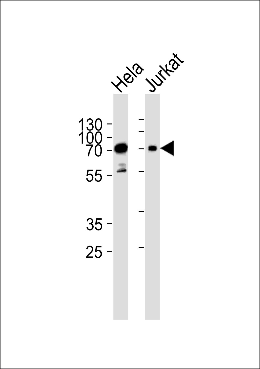 Mouse Pak3 (N-term)