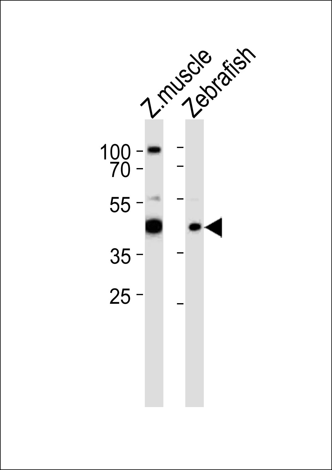 RBM22