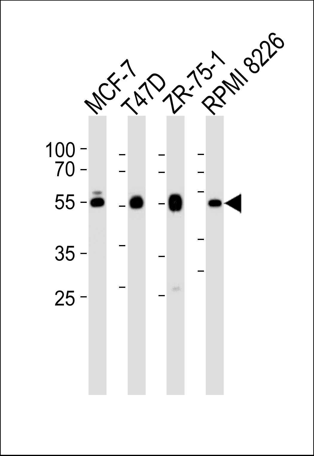 ZDHHC11