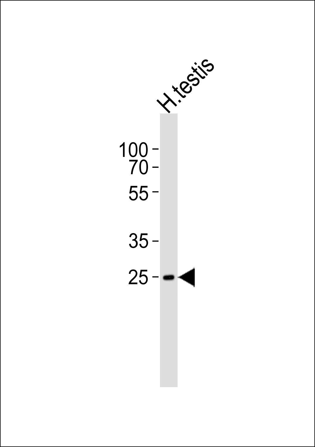C1orf201  (C-term)