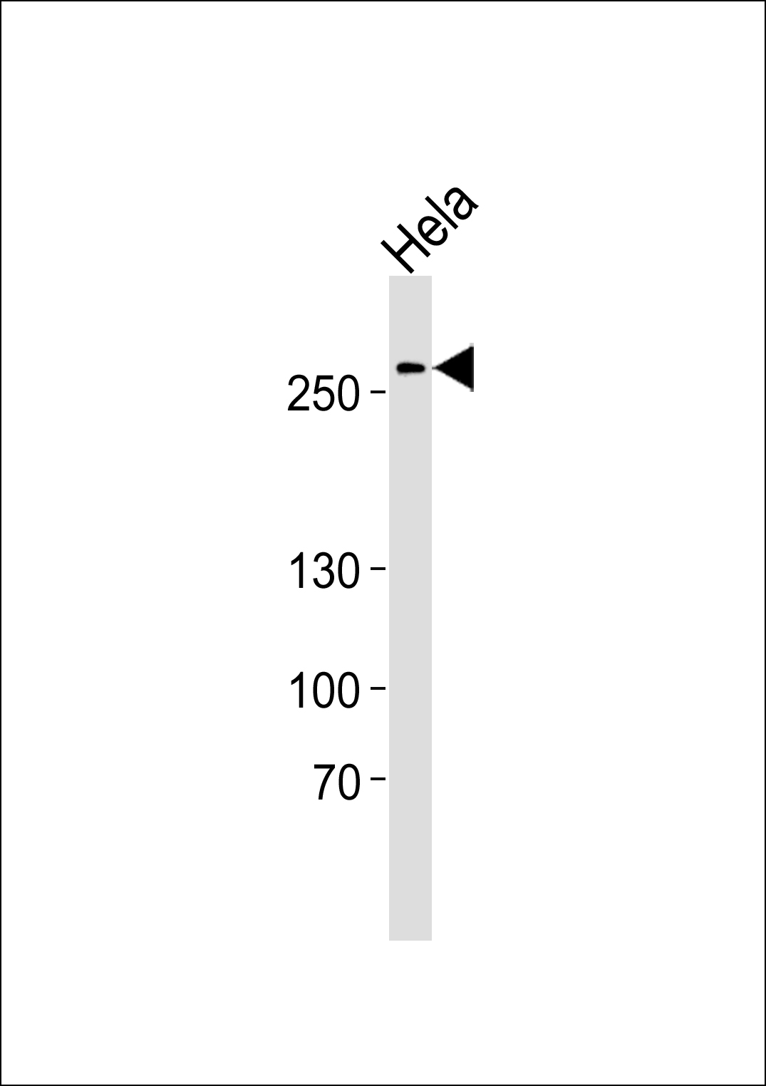 Human-AHCTF1 (S1232)