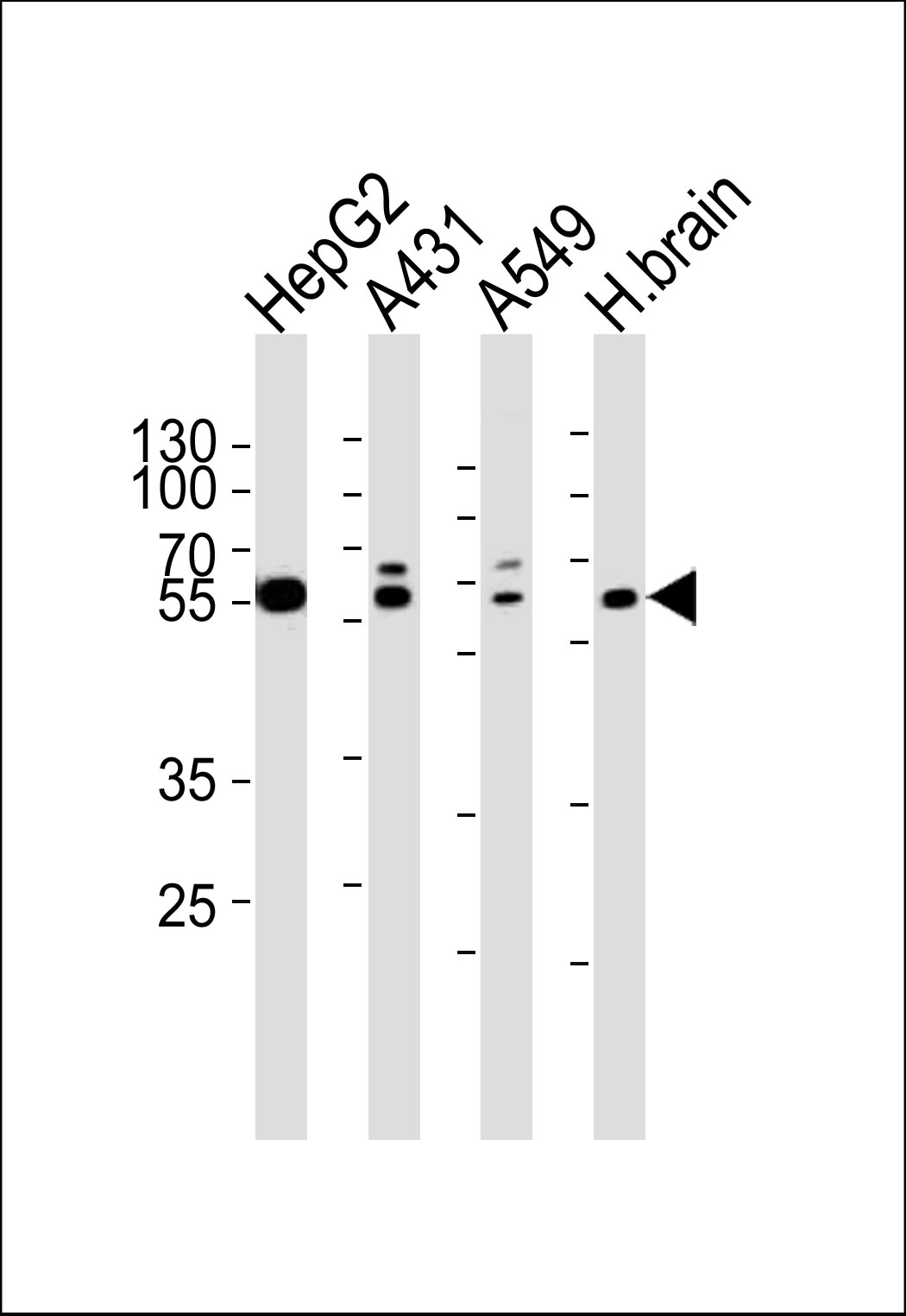 SERAC1 (N-term)