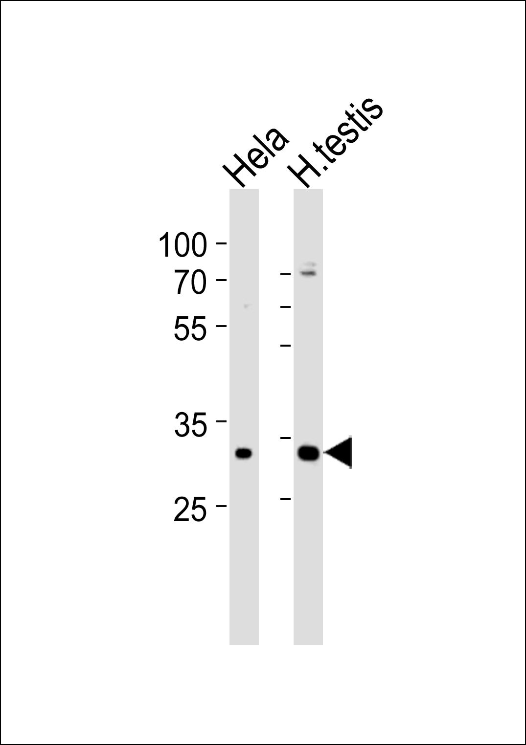 MTX2