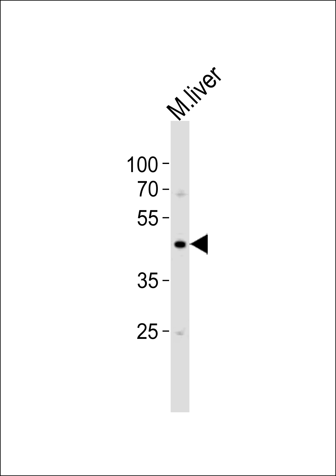 Mouse Csk (N-term)