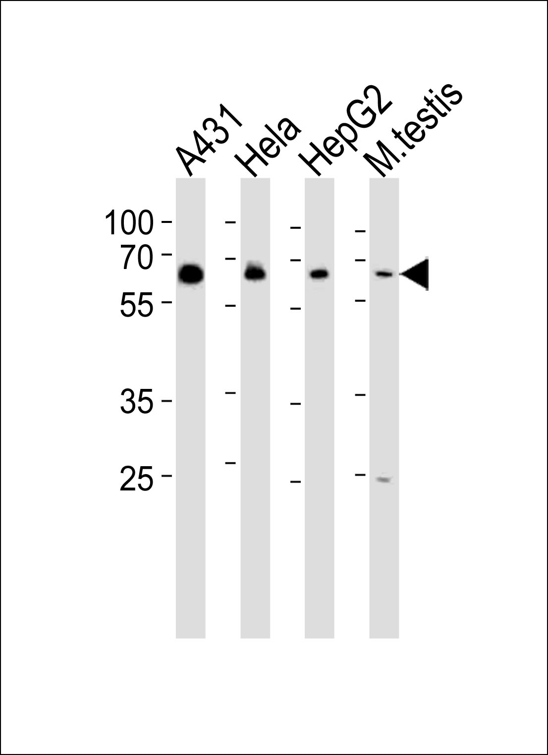 EHD4