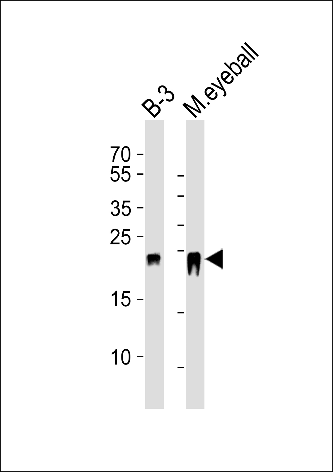 CRYBB2 (N-term)