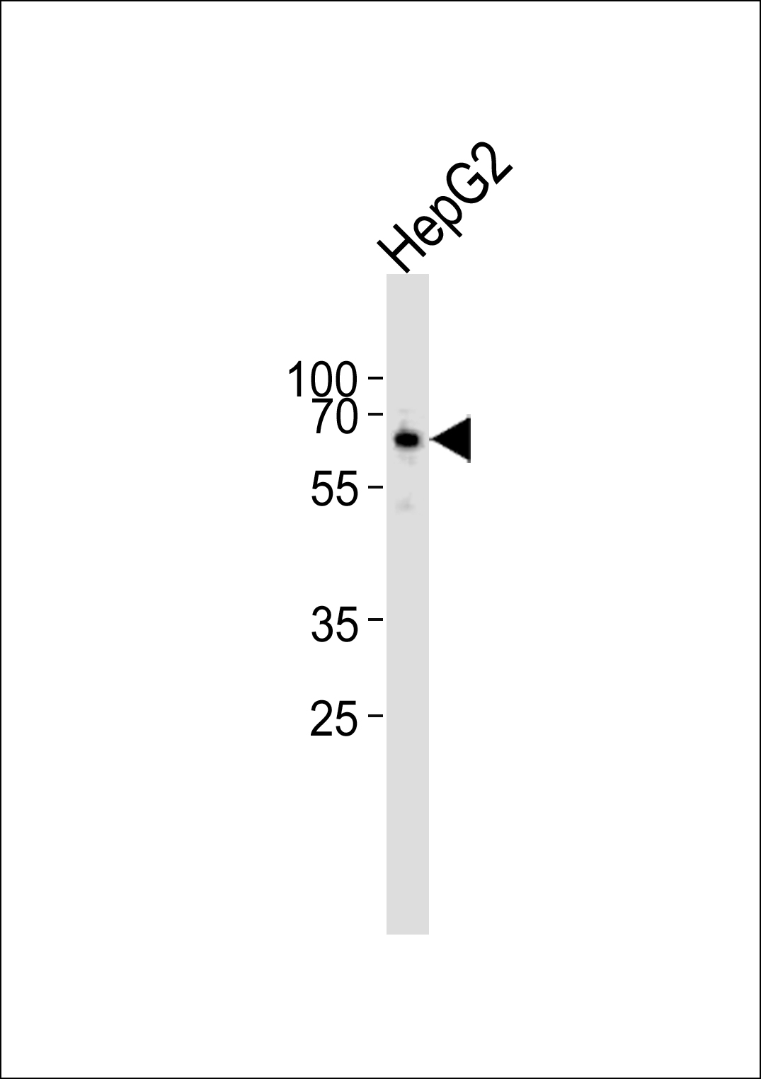 PET112 (N-term)