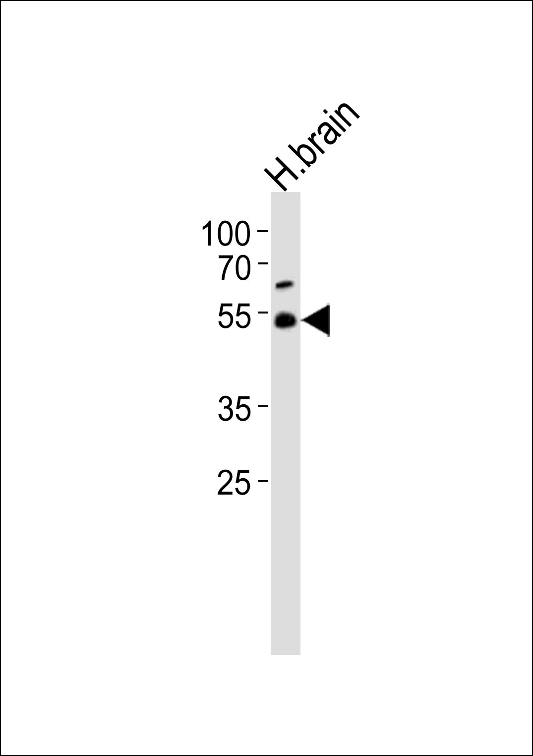 TRIM43B