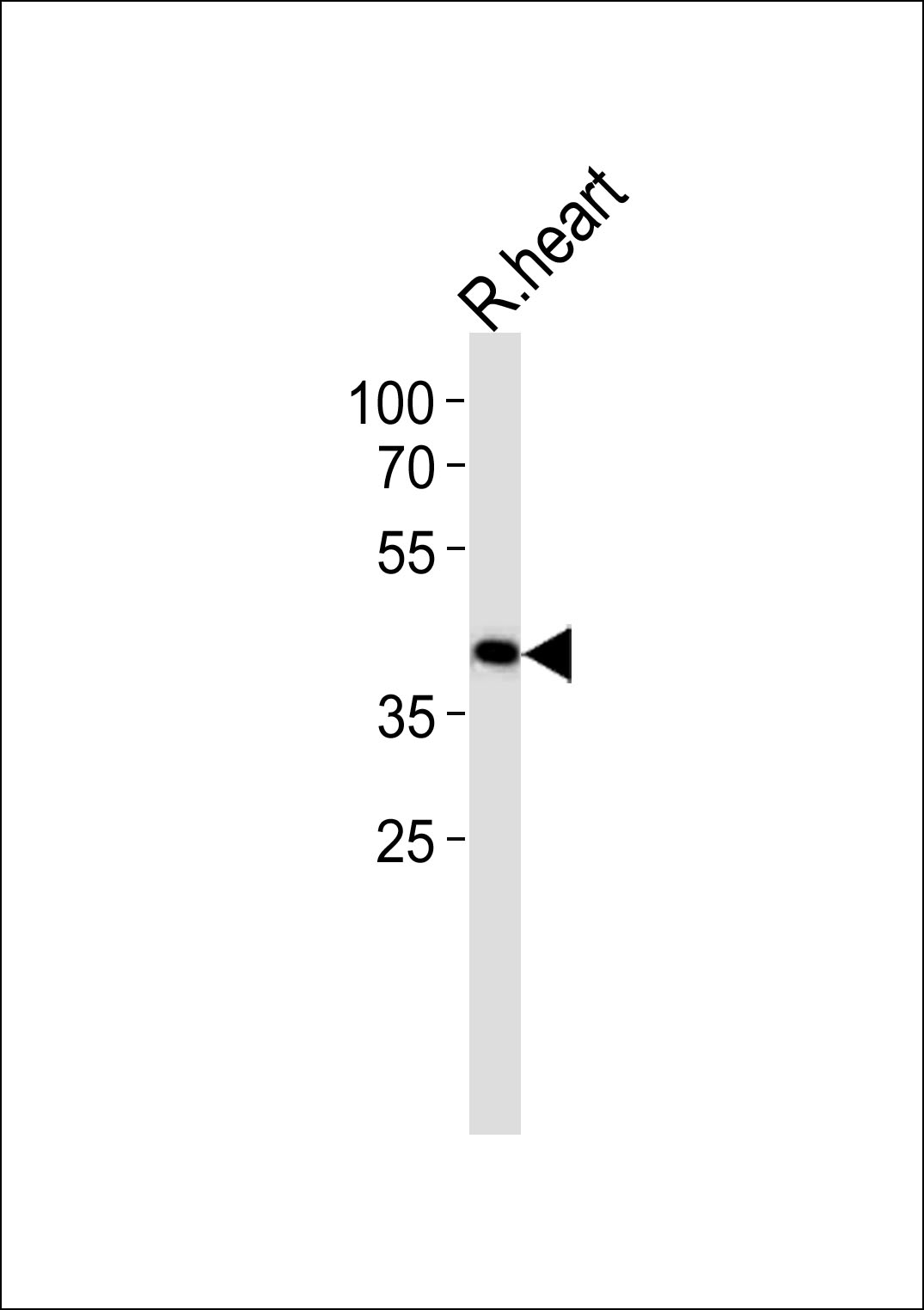 TOMM40L (N-term)