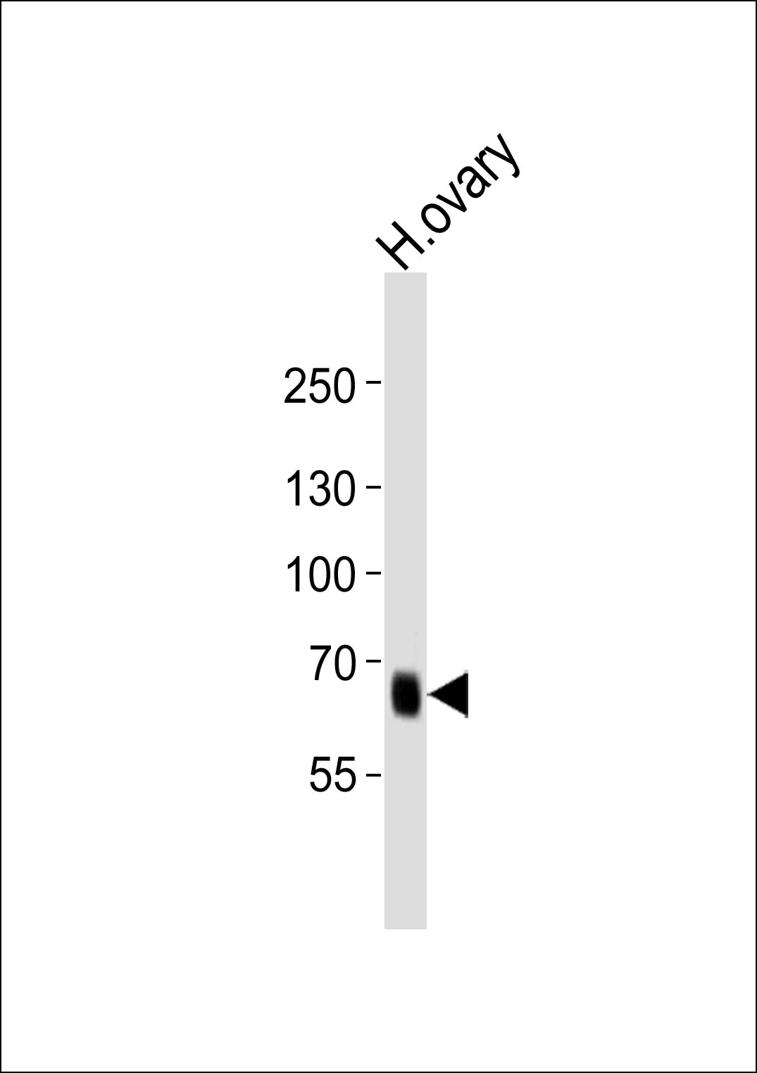PRDM13 (N-term)