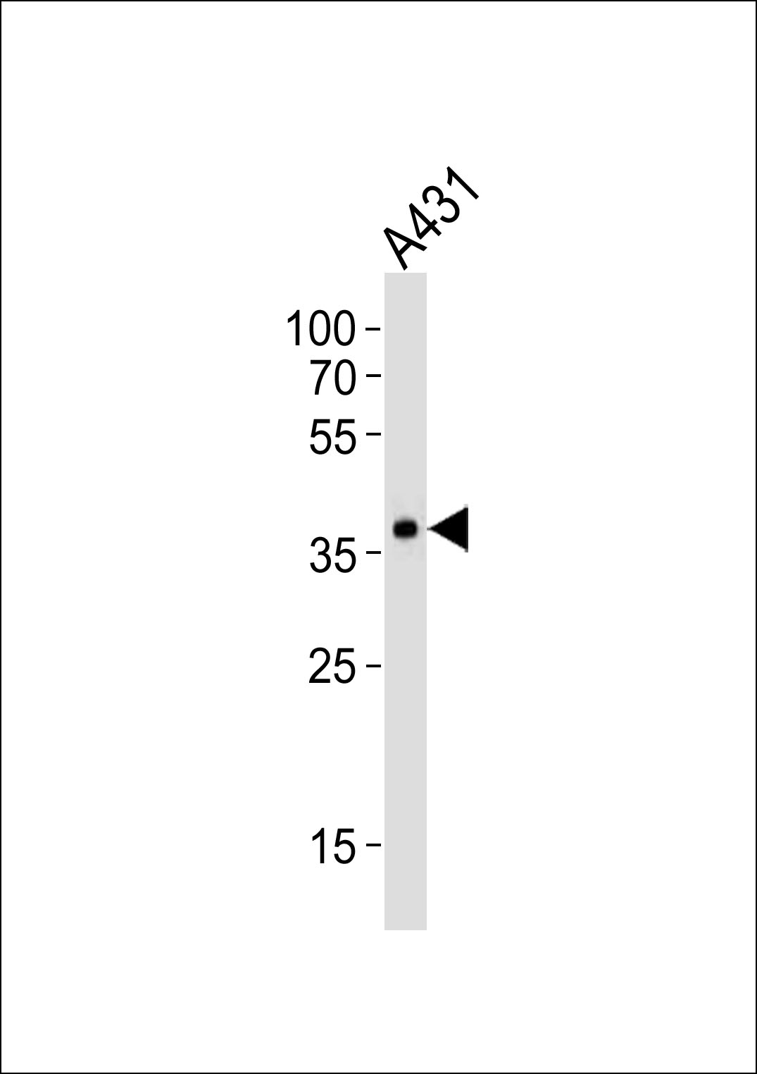 MUL1