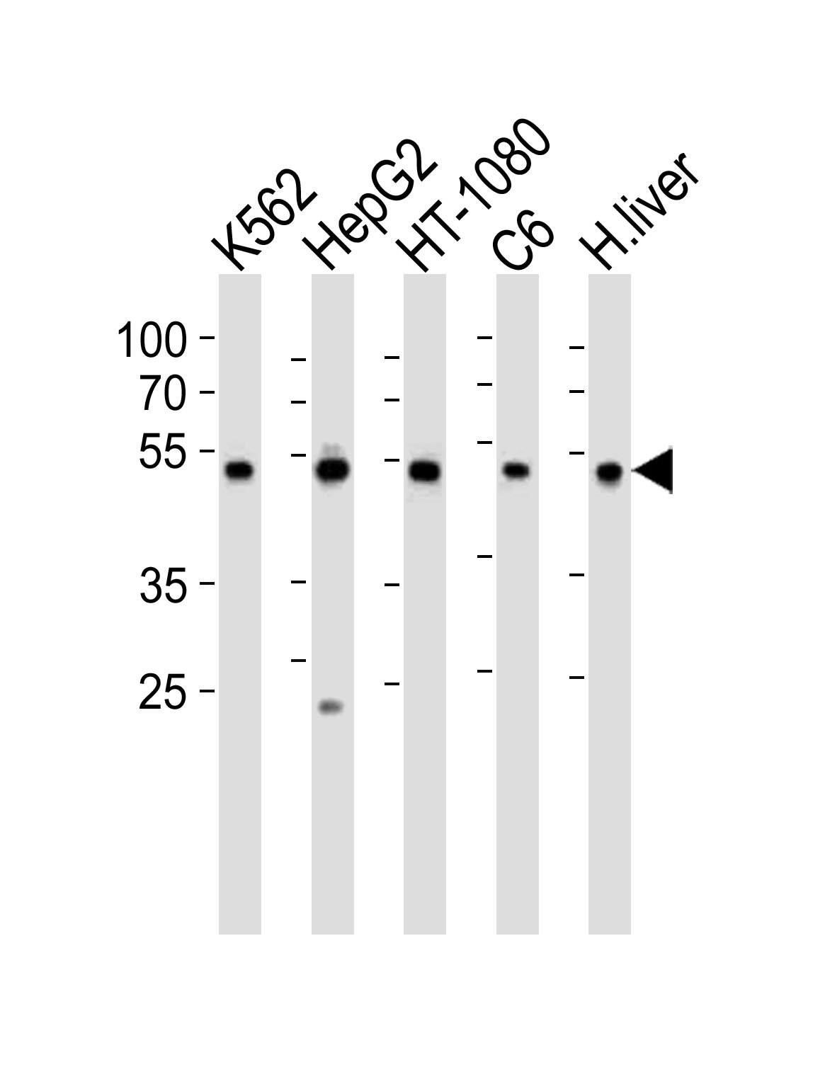 PDIA6 (Center K159)