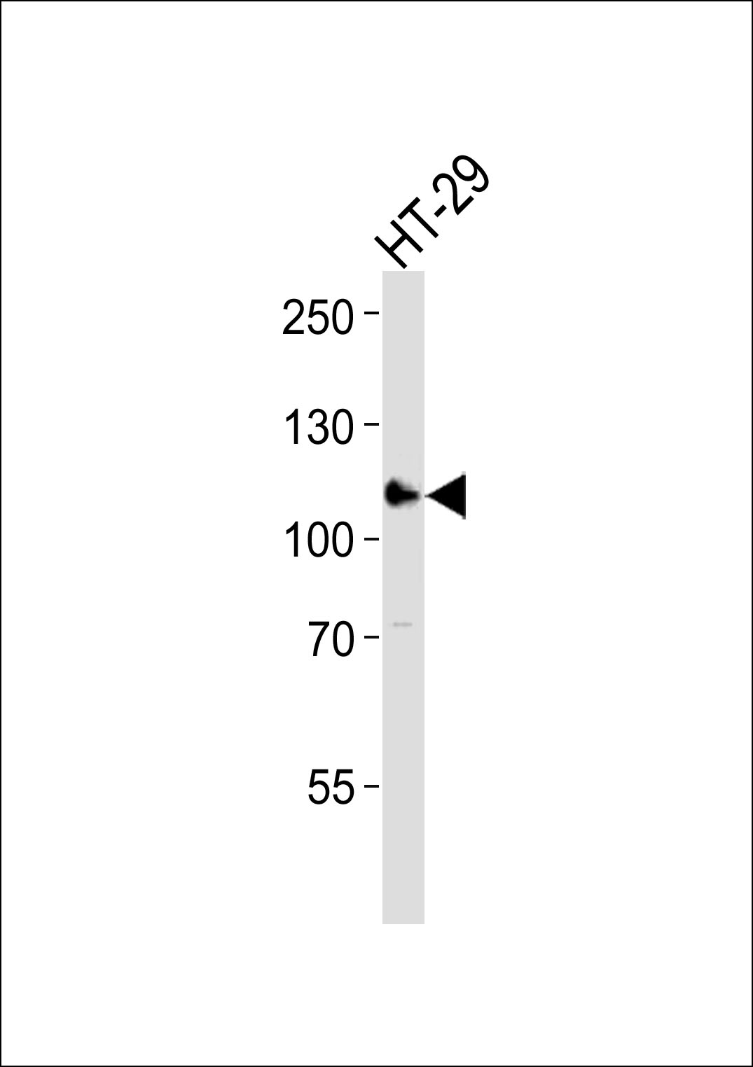 ERN2 (N-term)