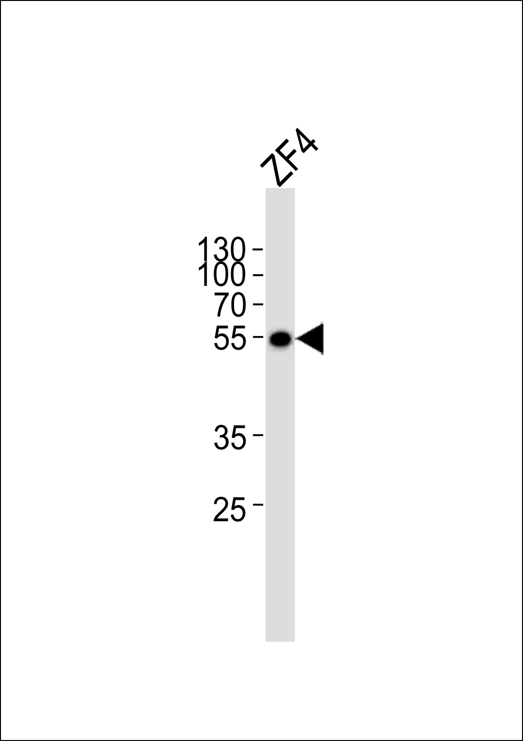 (DANRE) ankrd13c