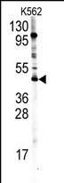 Rabbit Polyclonal Antibody to PRMT8