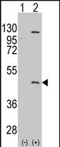 Rabbit Polyclonal Antibody to PRMT8