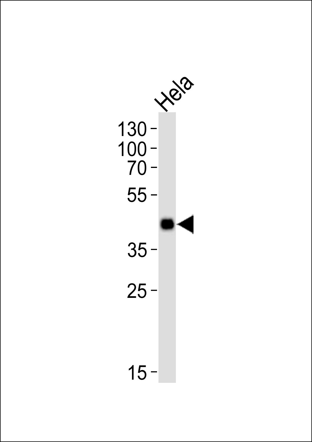 Mouse Mapkapk3 (N-term)