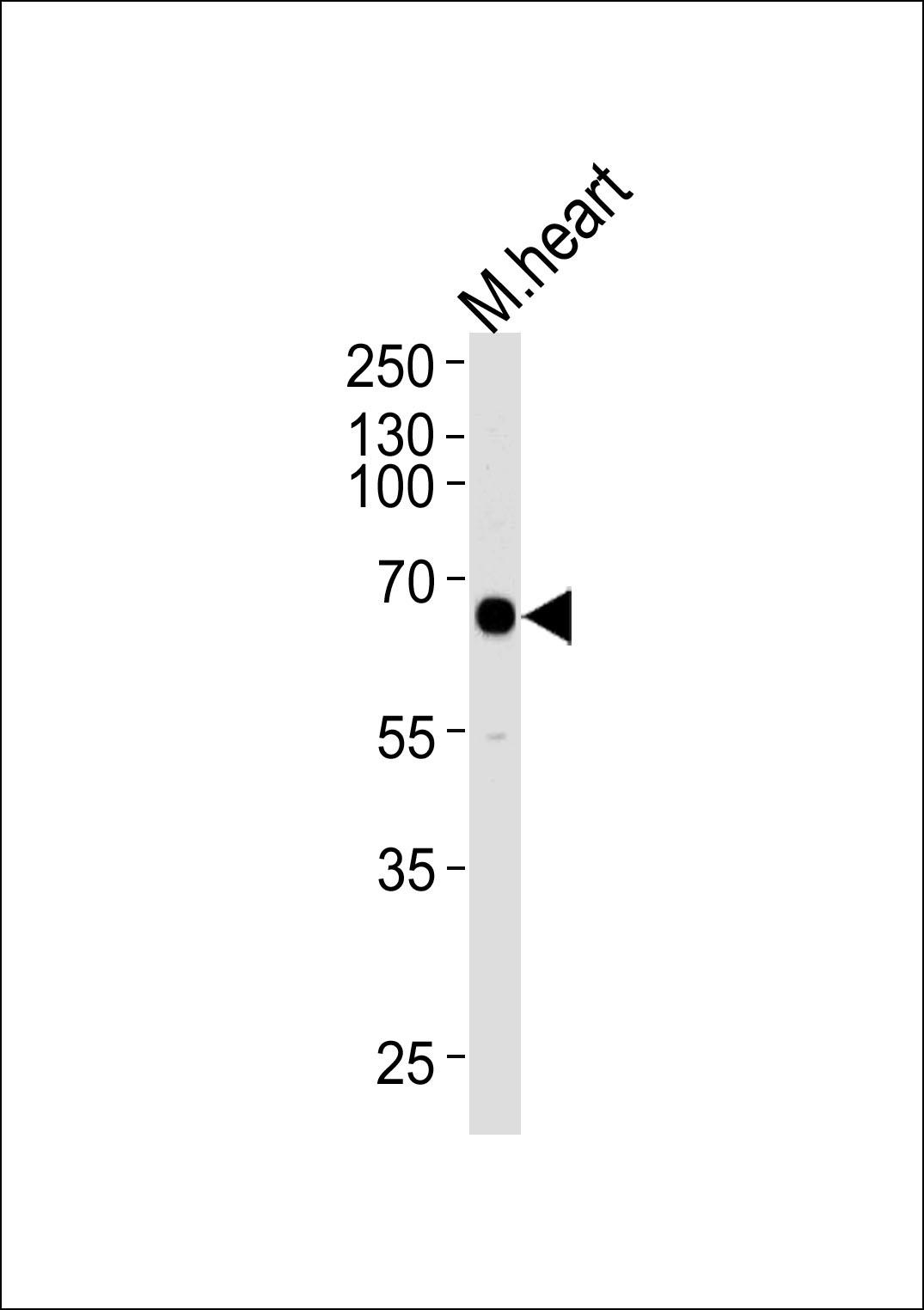Rabbit Polyclonal Antibody to Mouse Mapkapk3 (N-term)