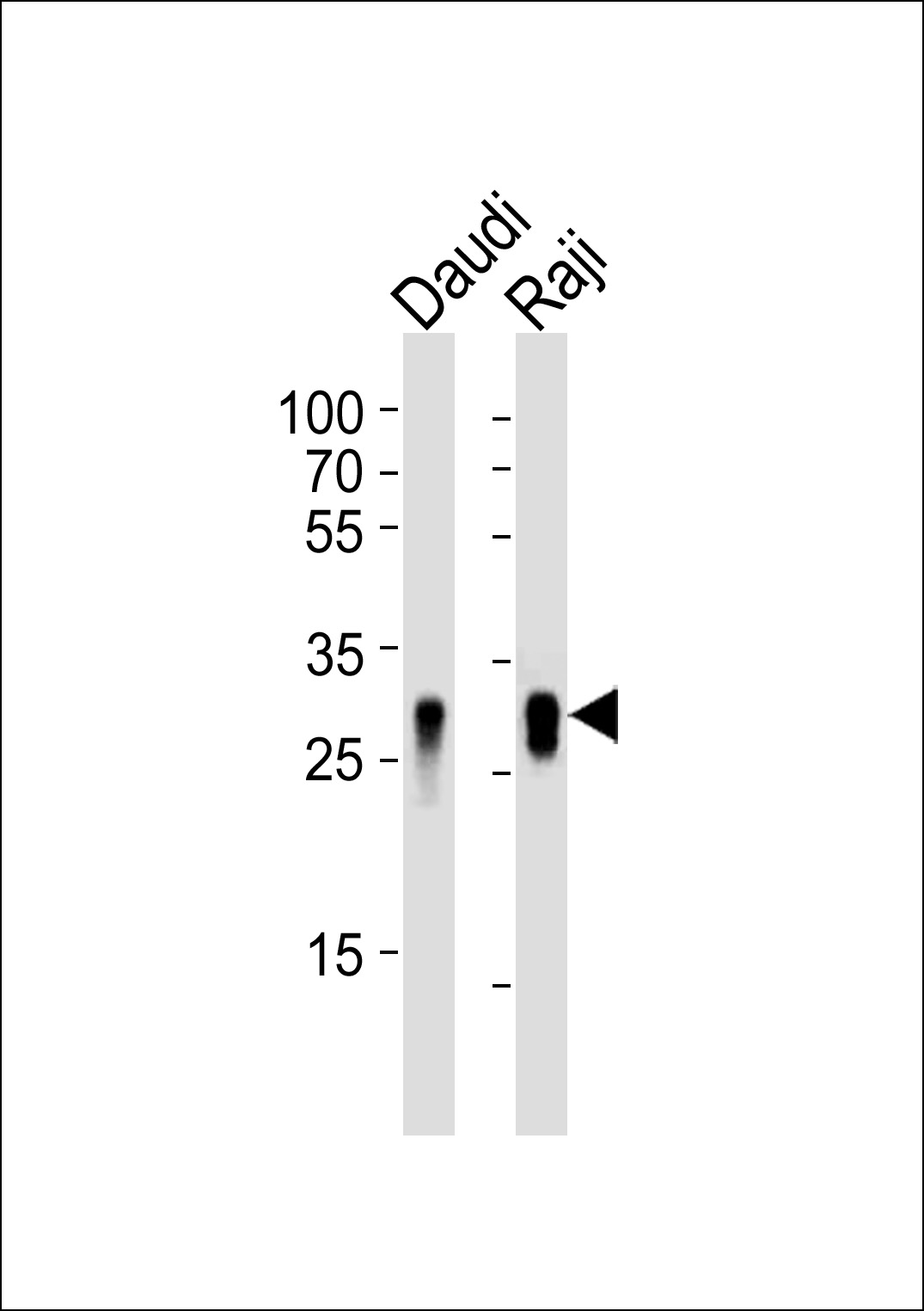 HLA-DRB1
