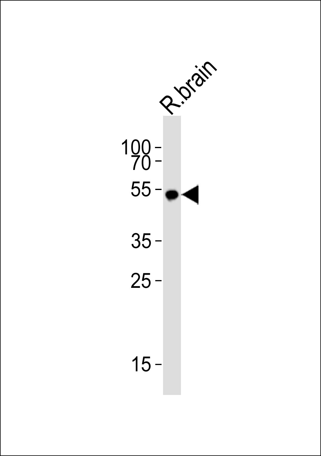 KCNJ16